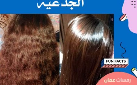 تساقط الشعر التفاعلى و المزمن